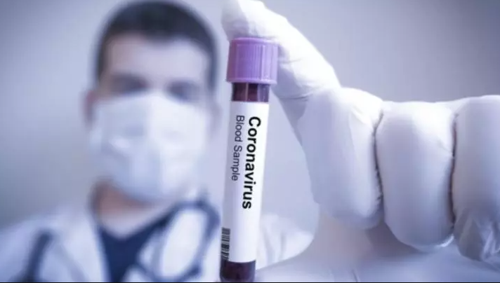 Cine poate face TEST GRATUIT pentru coronavirus în România. Descarcă LISTA CLINICILOR incluse în programul Guvernului